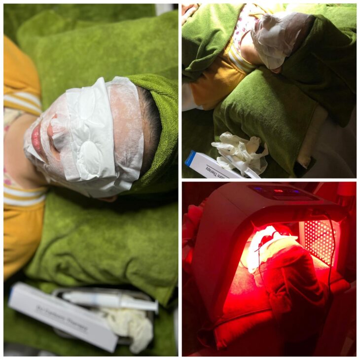 LIỆU TRÌNH THANG LỌC CO2 – THẢI ĐỘC TỐ TÙ TẦNG DA SÂU NHẤT. LIỆU TRÌNH THANG LỌC CO2 – THẢI ĐỘC TỐ TÙ TẦNG DA SÂU NHẤT.