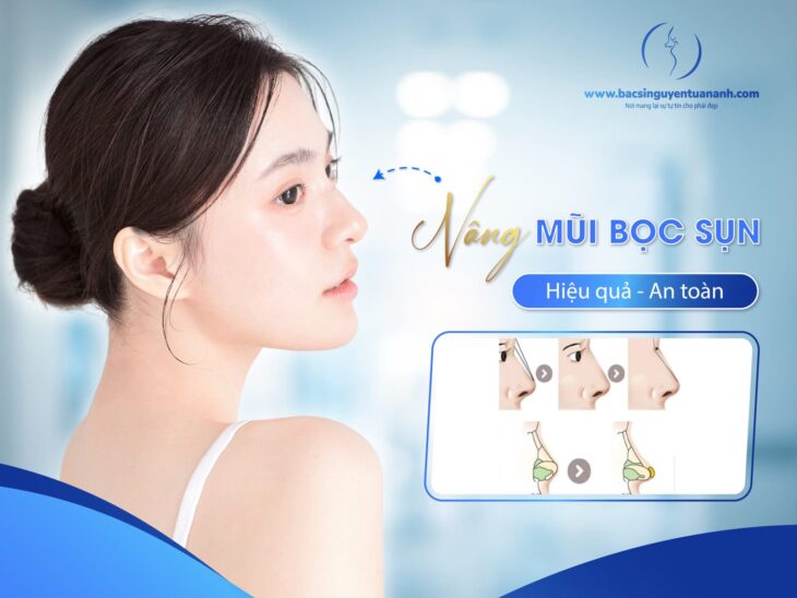 Bác Sĩ Thẩm Mỹ Nguyễn Tuấn Anh – Nâng mũi bọc sụn