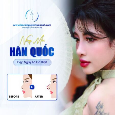 Nâng mũi Hàn Quốc đẹp ngay là có thật!!! Nâng mũi Hàn Quốc đẹp ngay là có thật!!!