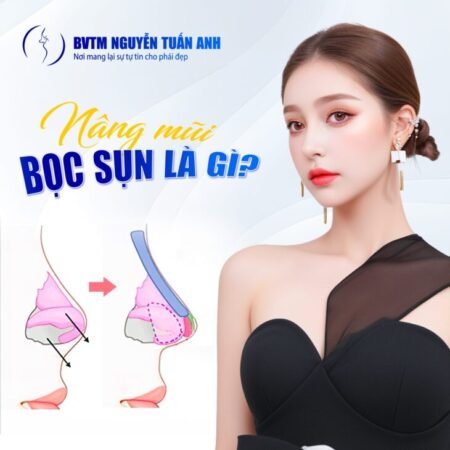 Nâng mũi bọc sụn tai có vĩnh viễn không? Nâng mũi bọc sụn tai có vĩnh viễn không?