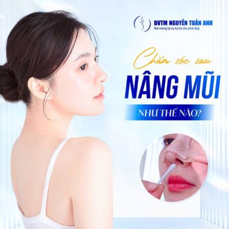 Chăm sóc sau nâng mũi như thế nào? Chăm sóc sau nâng mũi như thế nào?