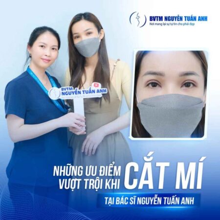Những ưu điểm vượt trội khi cắt mí tại BVTM Nguyễn Tuấn Anh Những ưu điểm vượt trội khi cắt mí tại BVTM Nguyễn Tuấn Anh