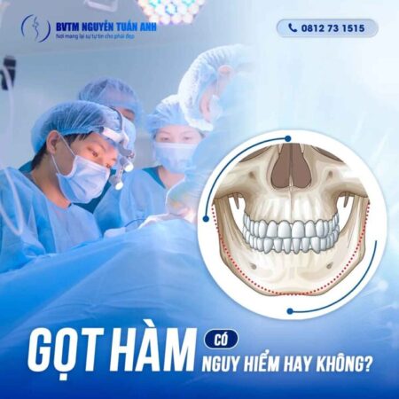 Gọt hàm V Line có nguy hiểm hay không? Gọt hàm V Line có nguy hiểm hay không?
