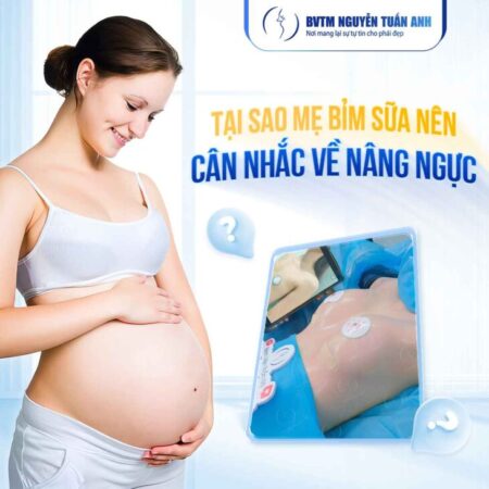 Những điều cần biết về nâng ngực cho mẹ bỉm sữa Những điều cần biết về nâng ngực cho mẹ bỉm sữa
