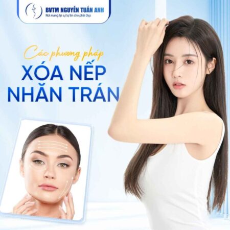 Các phương pháp căng da trán phổ biến hiện nay Các phương pháp căng da trán phổ biến hiện nay
