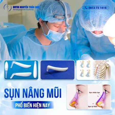 Những loại sụn nâng mũi phổ biến hiện nay Những loại sụn nâng mũi phổ biến hiện nay