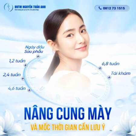 Những lưu ý sau khi PTTM nâng cung chân mày Những lưu ý sau khi PTTM nâng cung chân mày