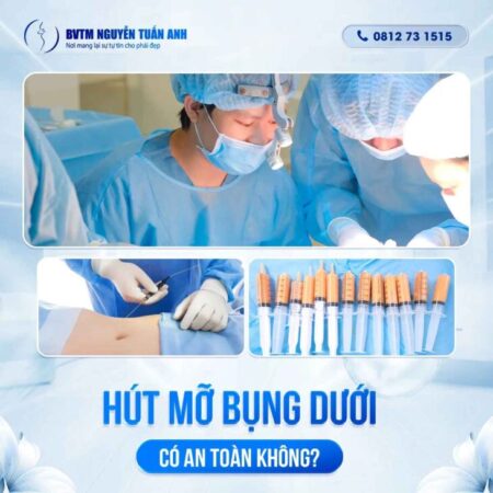 Hút mỡ bụng dưới có an toàn không? Hút mỡ bụng dưới có an toàn không?