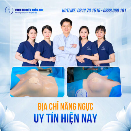 Nâng ngực nội soi Nâng ngực nội soi