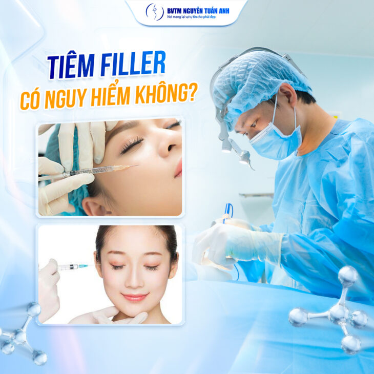 Tiêm Filler là gì và vì sao lại được ưa chuộng?