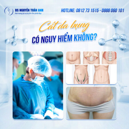 Cắt da bụng sau sinh có để lại sẹo không?