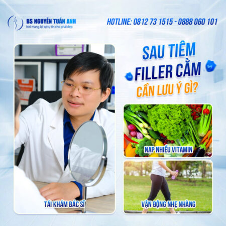 Sau khi tiêm filler cằm cần lưu ý gì?