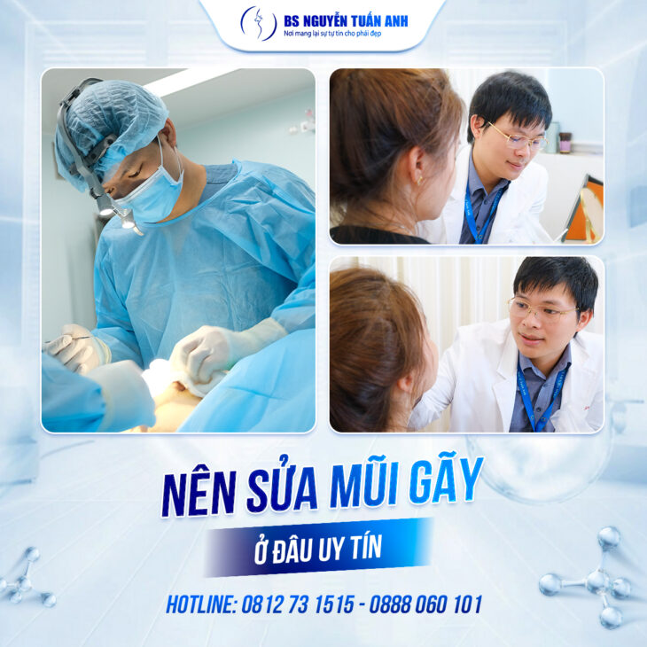 Mũi bị gãy có phải là tướng xấu