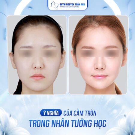 Cằm tròn đầy: Biểu tượng cuộc sống giàu sang viên mãn