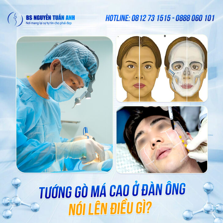Gò má đàn ông – Dấu ấn quyền lực hay “con dao hai lưỡi” với diện mạo