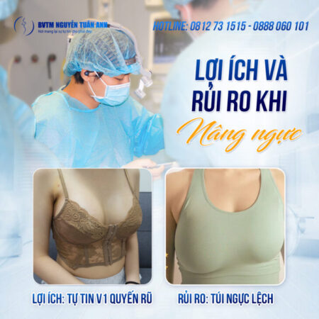 Nâng ngực nội soi là gì? Vì sao ngày càng phổ biến? Nâng ngực nội soi là gì? Vì sao ngày càng phổ biến?